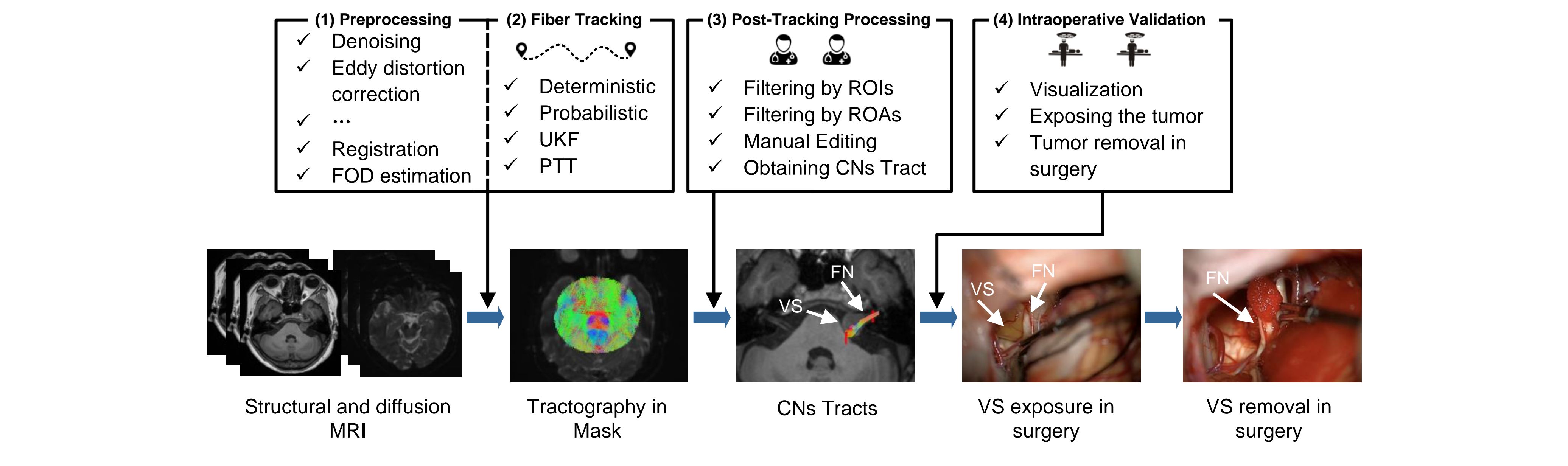 Automated Mapping the Pathways of Cranial Nerve II, III, V